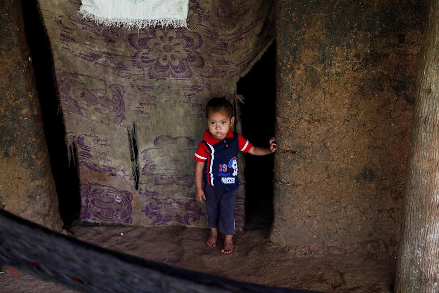 Un niño recuperado de desnutrición aguda en el Corredor Seco de Guatemala. Efeagro/Esteban Biba