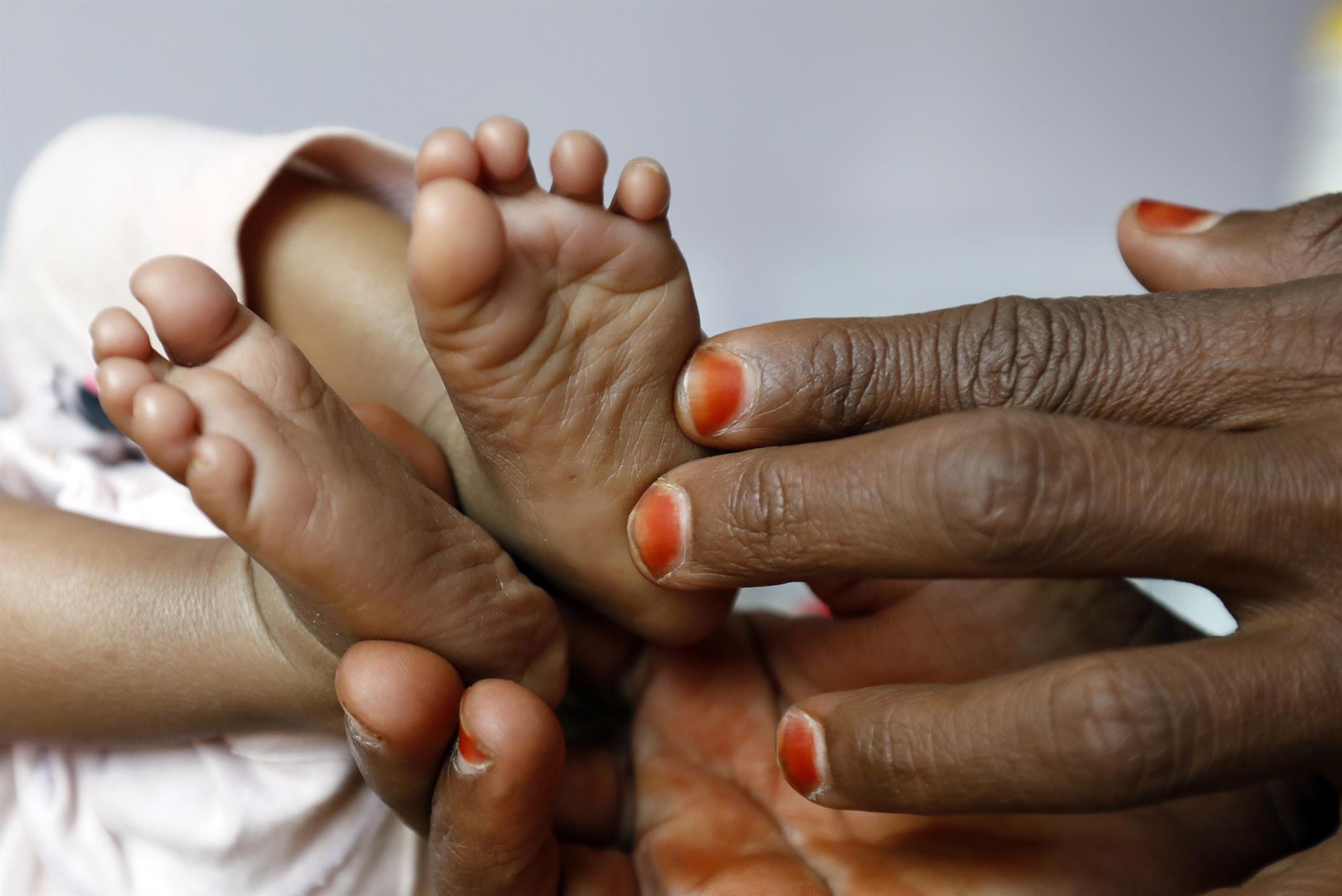 Una mujer sujeta las piernas de su hijo desnutrido en un hospital del Yemen. Efeagro/EPA/Yahya Arhab